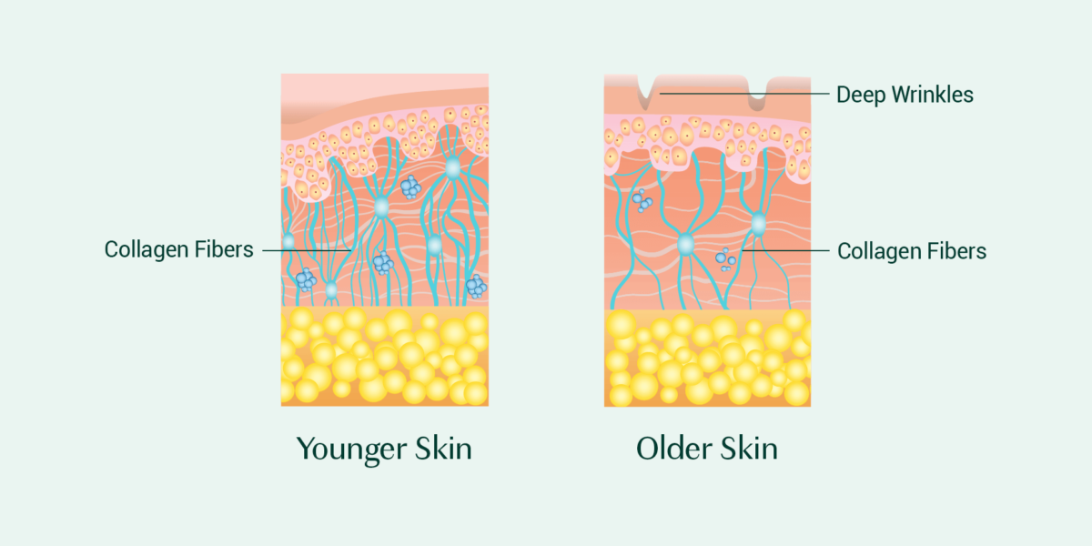 Collagen in younger skin versus older skin 