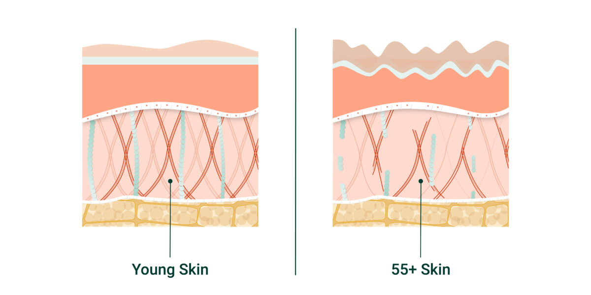 young skin vs older skin