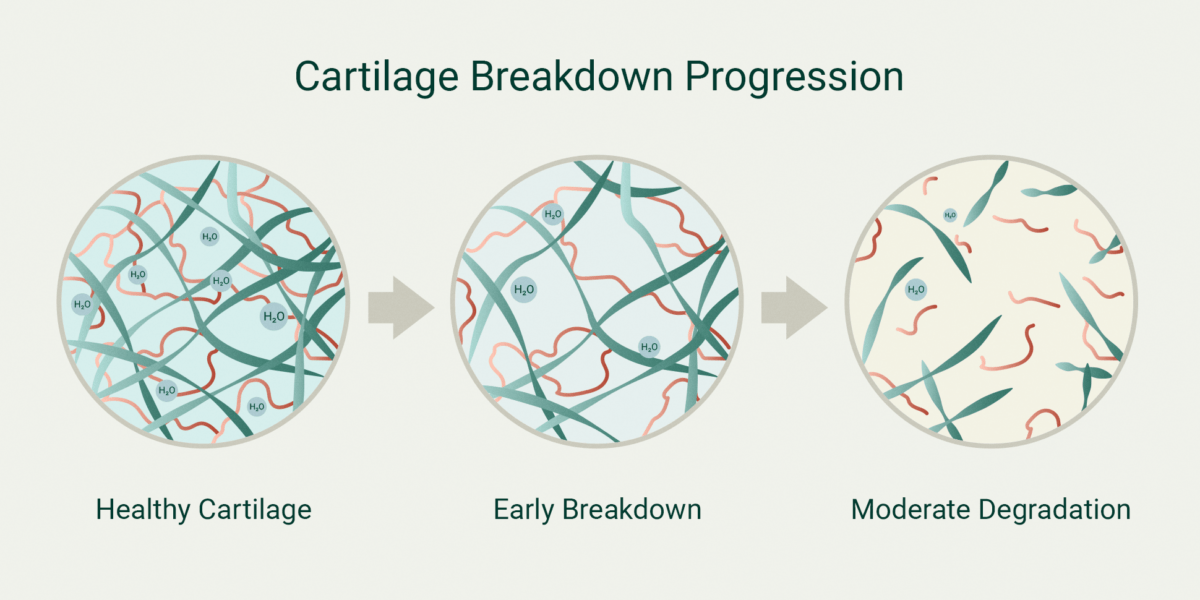 Cartilage Breakdown Progression