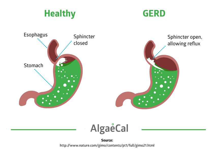 Healthy vs. GERD