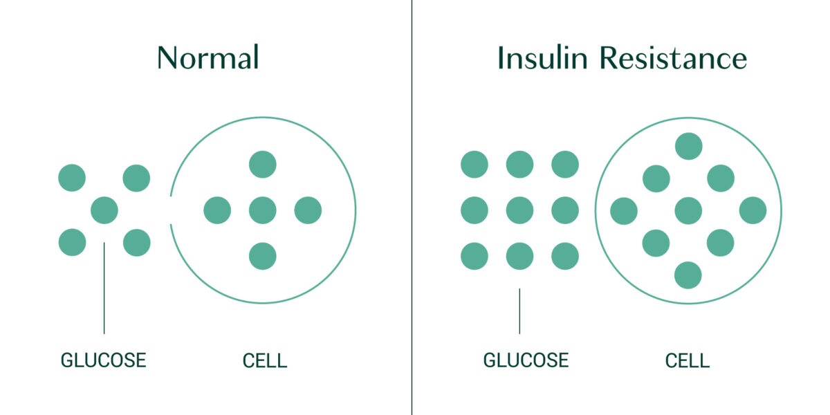 diabetes and glucose