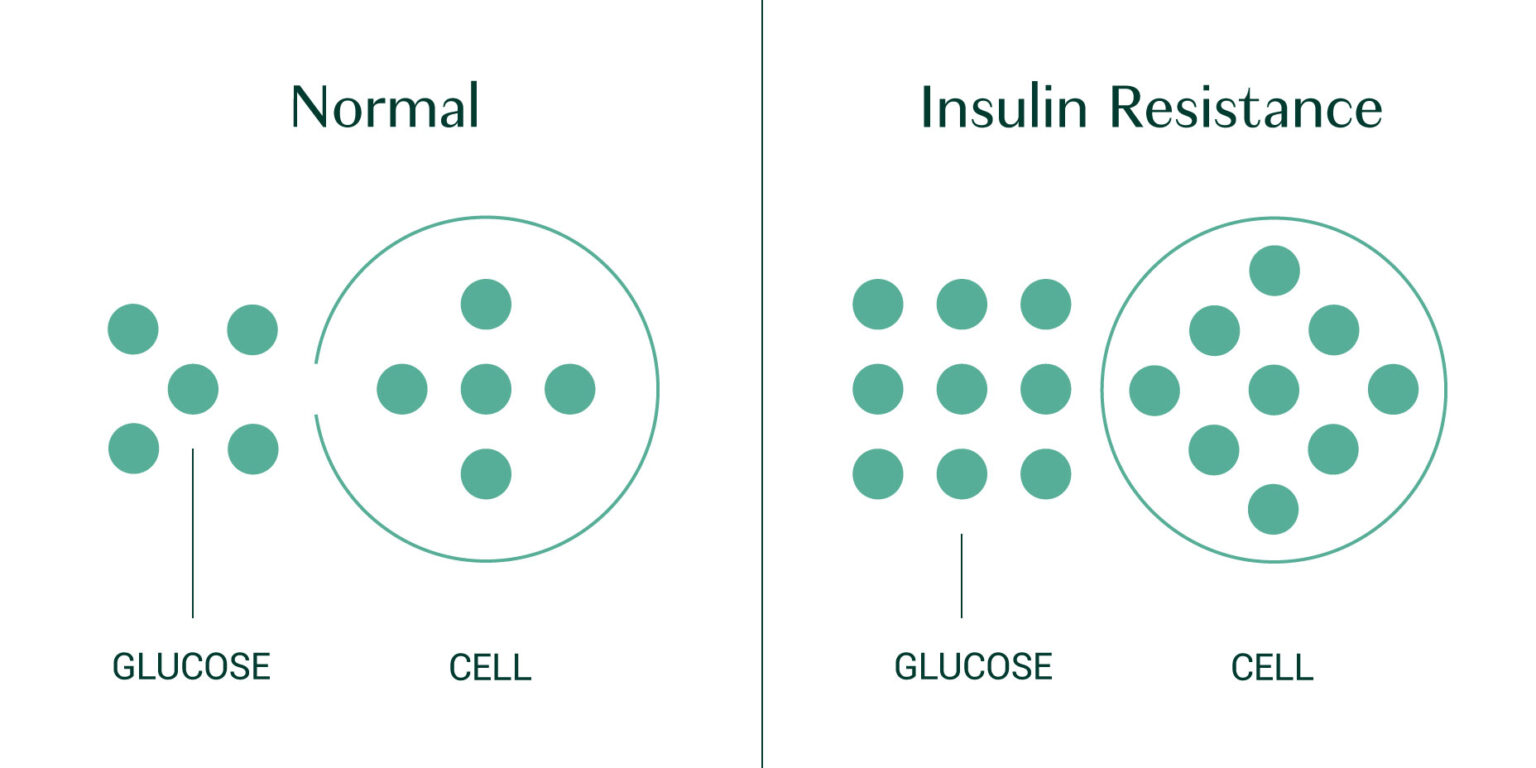 The Connection Between Vitamin D and Diabetes AlgaeCal