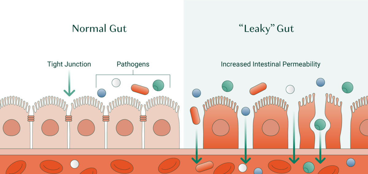 normal gut vs leaky gut