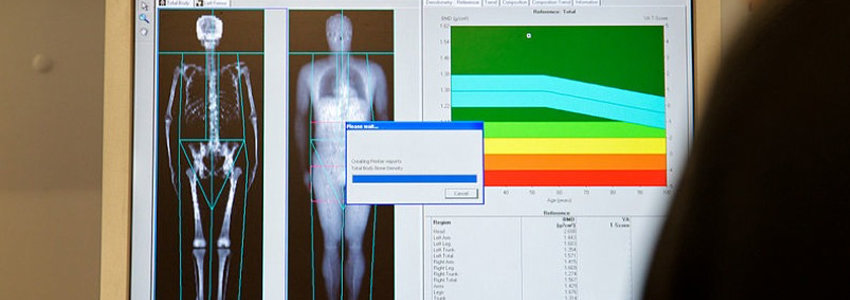 Bone scan image on a screen