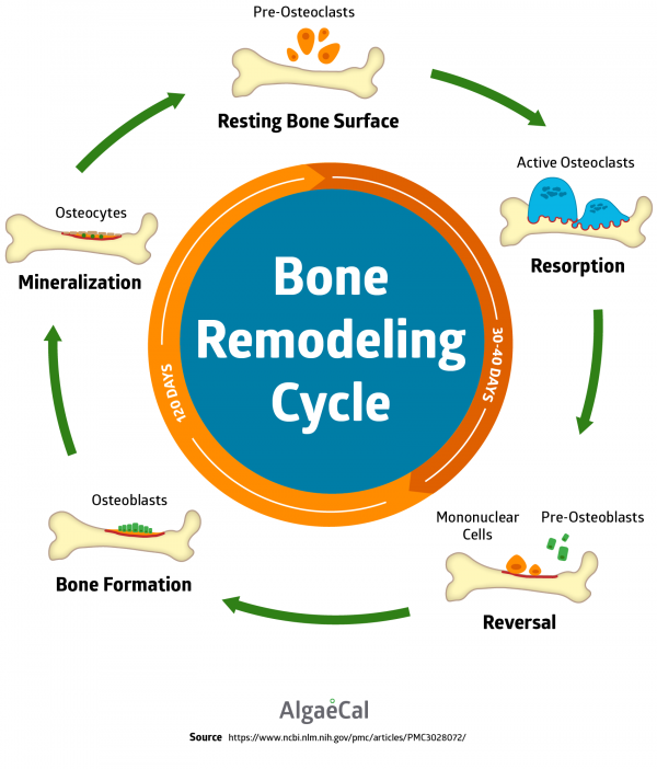 Osteomalacia Diagram